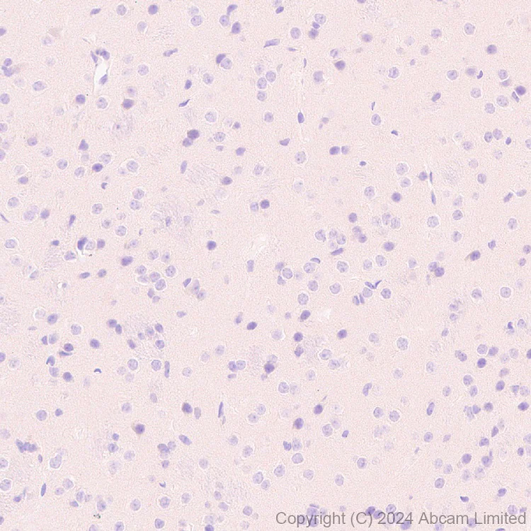 Immunohistochemistry (Formalin/PFA-fixed paraffin-embedded sections) - Anti-ADX antibody [EPR29804-54] - BSA and Azide free (AB321900)