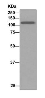Western blot - Anti-AE binding protein 1 antibody [EPR7733(2)] (AB168355)