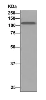 Western blot - Anti-AE binding protein 1 antibody [EPR7733(2)] (AB168355)