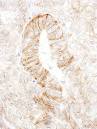 Immunohistochemistry (Formalin/PFA-fixed paraffin-embedded sections) - Anti-AE2 antibody (AB226829), expandable thumbnail