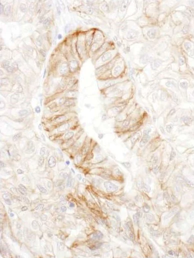 Immunohistochemistry (Formalin/PFA-fixed paraffin-embedded sections) - Anti-AE2 antibody (AB226829)