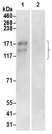 Immunoprecipitation - Anti-AE2 antibody (AB226829), expandable thumbnail
