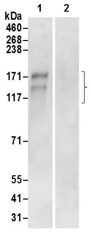 Immunoprecipitation - Anti-AE2 antibody (AB226829)