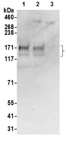 Western blot - Anti-AE2 antibody (AB226829), expandable thumbnail