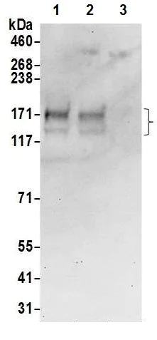 Western blot - Anti-AE2 antibody (AB226829)