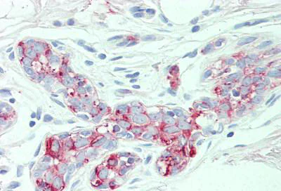 Immunohistochemistry (Formalin/PFA-fixed paraffin-embedded sections) - Anti-AE2 antibody - N-terminal (AB140953)