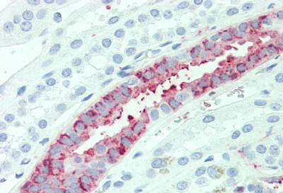 Immunohistochemistry (Formalin/PFA-fixed paraffin-embedded sections) - Anti-AE2 antibody - N-terminal (AB140953)