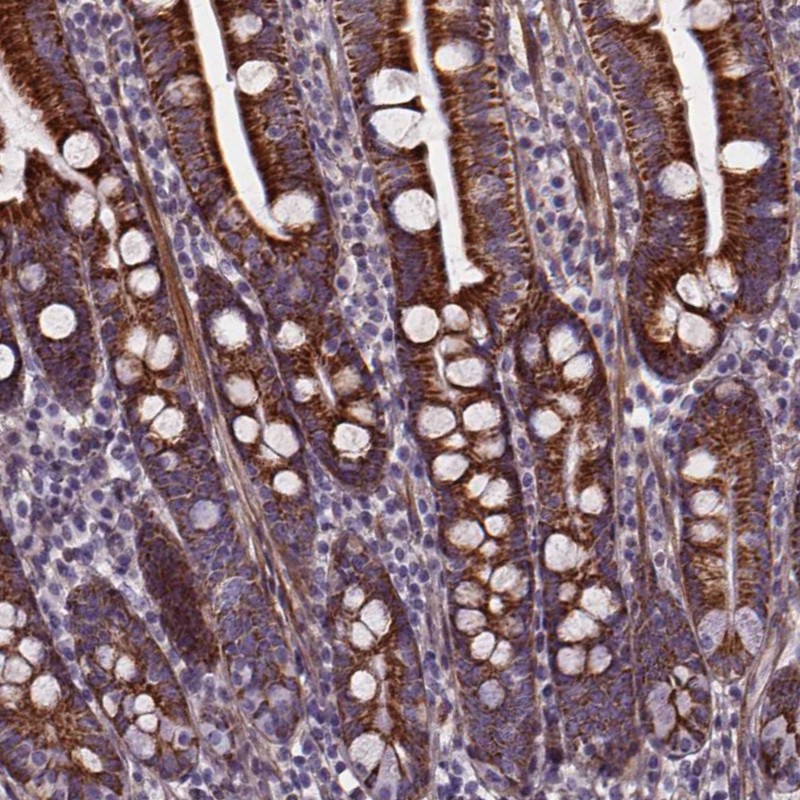 Immunohistochemistry (Formalin/PFA-fixed paraffin-embedded sections) - Anti-AEBP1 antibody (AB254970)