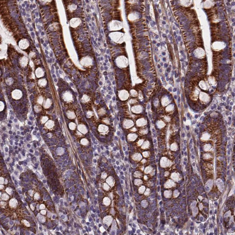 Immunohistochemistry (Formalin/PFA-fixed paraffin-embedded sections) - Anti-AEBP1 antibody (AB254970)