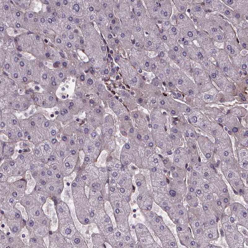 Immunohistochemistry (Formalin/PFA-fixed paraffin-embedded sections) - Anti-AEBP1 antibody (AB254973)