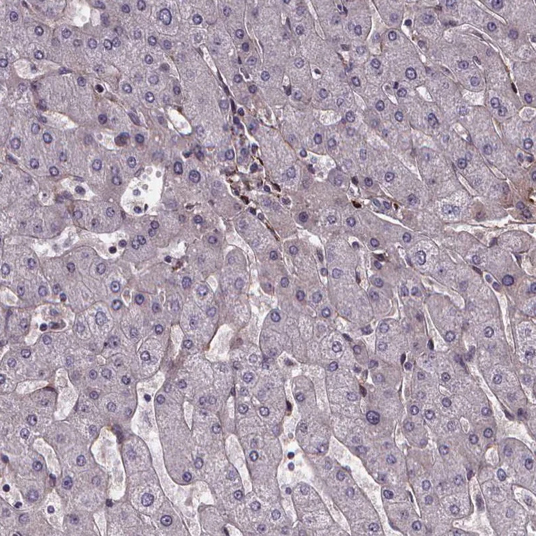 Immunohistochemistry (Formalin/PFA-fixed paraffin-embedded sections) - Anti-AEBP1 antibody (AB254973)