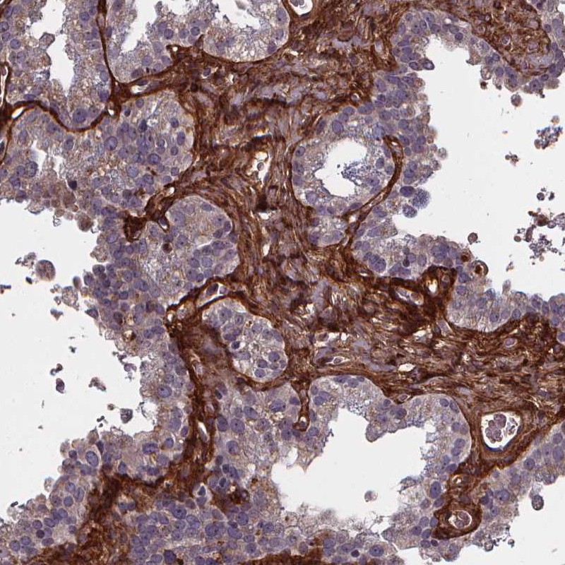 Immunohistochemistry (Formalin/PFA-fixed paraffin-embedded sections) - Anti-AEBP1 antibody (AB254973)