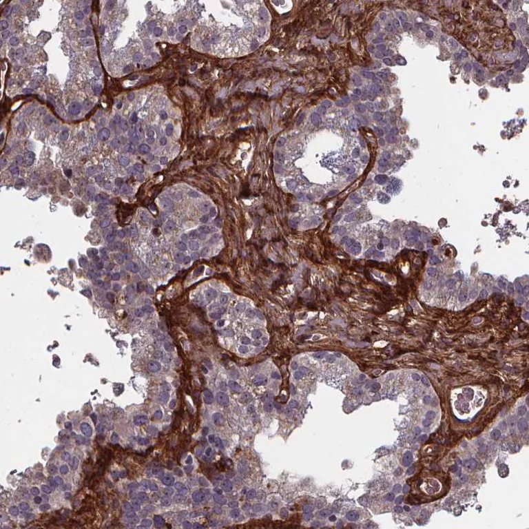 Immunohistochemistry (Formalin/PFA-fixed paraffin-embedded sections) - Anti-AEBP1 antibody (AB254973)