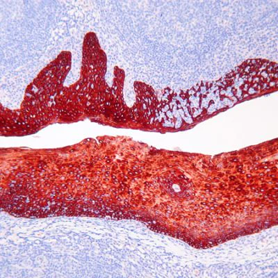 Immunohistochemistry (Formalin/PFA-fixed paraffin-embedded sections) - AEC Single/Plus (30ml) (AB103742)