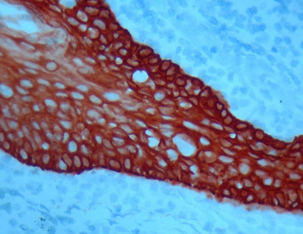 Immunohistochemistry (Formalin/PFA-fixed paraffin-embedded sections) - AEC Single/Plus (30ml) (AB103742), expandable thumbnail