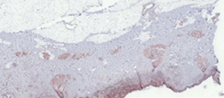 Immunohistochemistry (Formalin/PFA-fixed paraffin-embedded sections) - AEC Substrate Kit (AB64252)