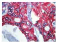 Immunohistochemistry (Formalin/PFA-fixed paraffin-embedded sections) - AEC Substrate Kit (AB64252)
