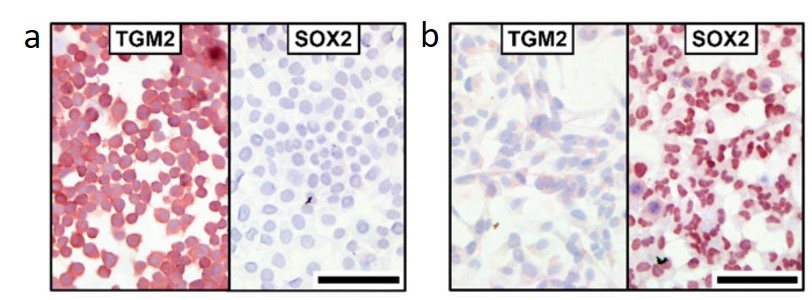 Immunohistochemistry (Frozen sections) - AEC Substrate Kit (AB64252), expandable thumbnail