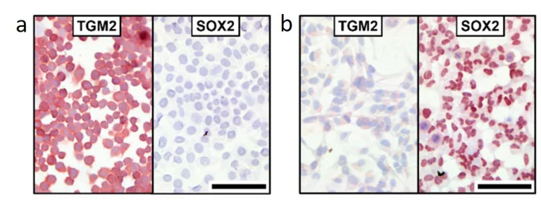 Immunohistochemistry (Frozen sections) - AEC Substrate Kit (AB64252)