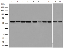 Western blot - Anti-AER61 antibody [EPR12944] - BSA and Azide free (AB251028), expandable thumbnail