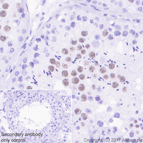 Immunohistochemistry (Formalin/PFA-fixed paraffin-embedded sections) - Anti-AF10 antibody [EPR20810] (AB208016)
