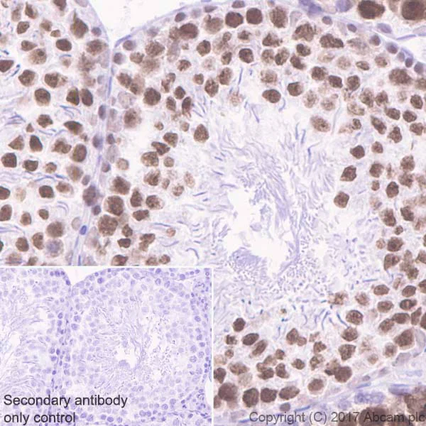 Immunohistochemistry (Formalin/PFA-fixed paraffin-embedded sections) - Anti-AF10 antibody [EPR20810] (AB208016)