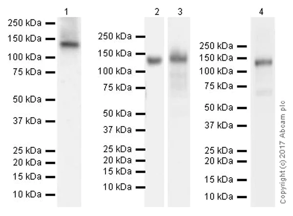 Western blot - Anti-AF10 antibody [EPR20810] (AB208016)