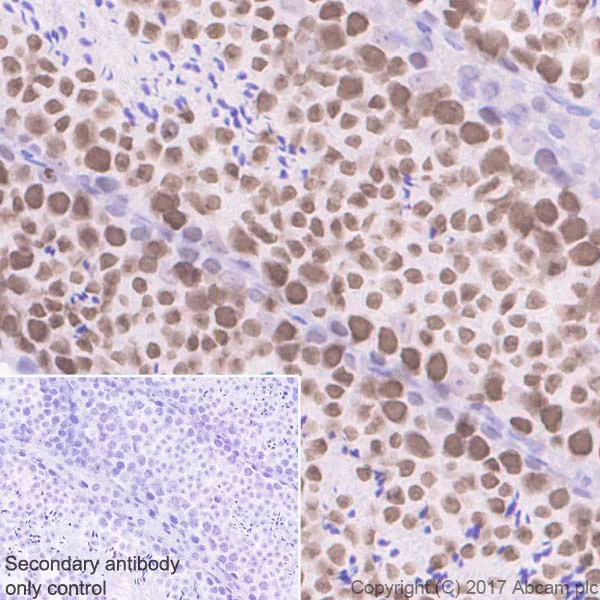 Immunohistochemistry (Formalin/PFA-fixed paraffin-embedded sections) - Anti-AF10 antibody [EPR20810] - BSA and Azide free (AB230376)