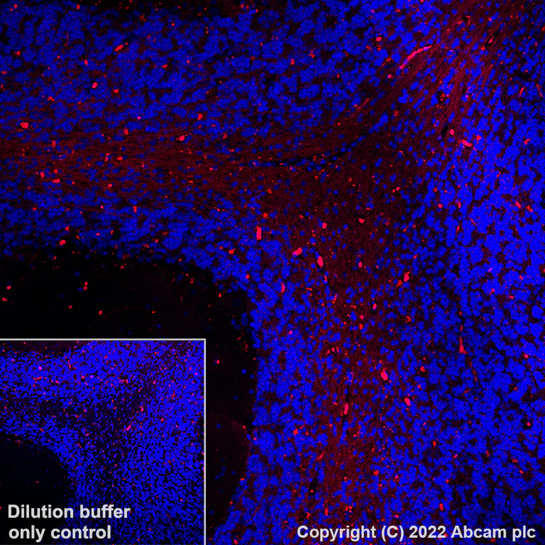 Immunohistochemistry (Formalin/PFA-fixed paraffin-embedded sections) - AF555 Anti-Myelin oligodendrocyte glycoprotein antibody [EPR22629-310] - Oligodendrocyte Marker (AB307127)