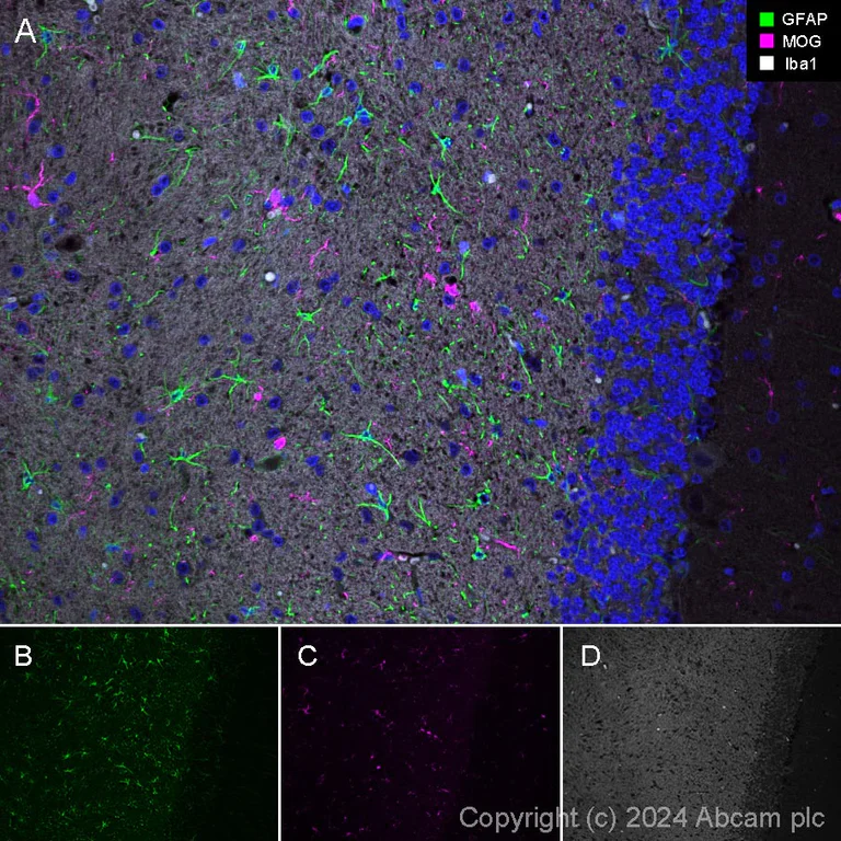 Immunohistochemistry (Formalin/PFA-fixed paraffin-embedded sections) - AF594 Anti-Myelin oligodendrocyte glycoprotein antibody [EPR22629-310] - Oligodendrocyte Marker (AB305372)