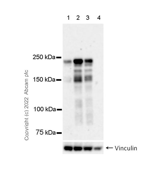 Western blot - Anti-AF6 antibody [35/AF6] - BSA and Azide Free (AB300636), expandable thumbnail