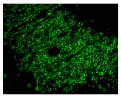 Immunohistochemistry (Formalin/PFA-fixed paraffin-embedded sections) - Anti-AF6 antibody [A7L9H48] (AB203569)
