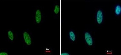 Immunocytochemistry/ Immunofluorescence - Anti-AF9 antibody (AB154492), expandable thumbnail