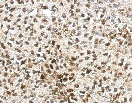 Immunohistochemistry (Formalin/PFA-fixed paraffin-embedded sections) - Anti-AF9 antibody (AB154492)