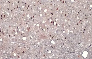 Immunohistochemistry (Formalin/PFA-fixed paraffin-embedded sections) - Anti-AF9 antibody (AB154492)