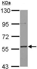 Western blot - Anti-AF9 antibody (AB154492), expandable thumbnail