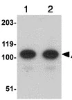 Western blot - Anti-AFAP1L2 antibody (AB106433)