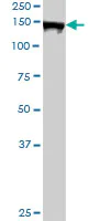 Western blot - Anti-AFF4 antibody (AB103586)