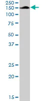 Western blot - Anti-AFF4 antibody (AB103586)