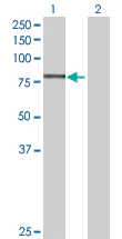 Western blot - Anti-AFG3L2 antibody (AB68023)