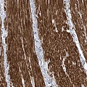 Immunohistochemistry (Formalin/PFA-fixed paraffin-embedded sections) - Anti-Aftiphilin antibody (AB122239)