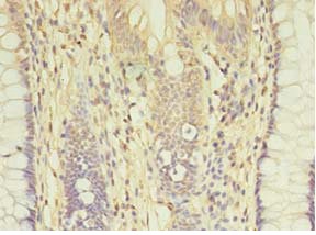 Immunohistochemistry (Formalin/PFA-fixed paraffin-embedded sections) - Anti-AGBL2 antibody (AB235778), expandable thumbnail