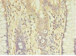 Immunohistochemistry (Formalin/PFA-fixed paraffin-embedded sections) - Anti-AGBL2 antibody (AB235778)