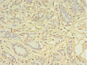 Immunohistochemistry (Formalin/PFA-fixed paraffin-embedded sections) - Anti-AGBL2 antibody (AB235778), expandable thumbnail
