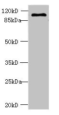 Western blot - Anti-AGBL2 antibody (AB235778), expandable thumbnail