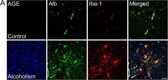 Immunohistochemistry (Frozen sections) - Anti-AGE (Advanced Glycation End-products) antibody (AB23722)