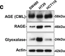 Western blot - Anti-AGE (Advanced Glycation End-products) antibody (AB23722)