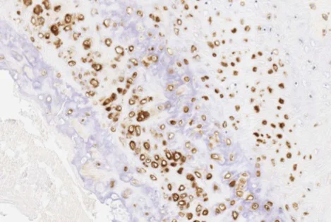 Immunohistochemistry (Formalin/PFA-fixed paraffin-embedded sections) - Anti-Aggrecan antibody [6-B-4] (AB3778)