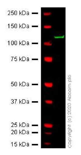 Western blot - Anti-Aggrecan antibody [6-B-4] (AB3778)