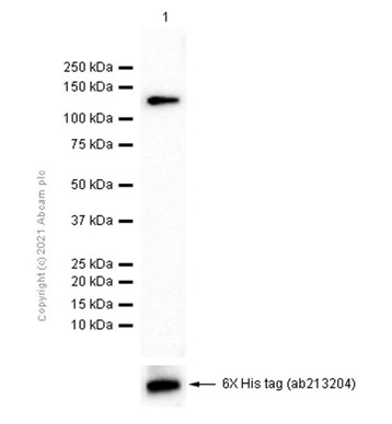 Western blot - Anti-Aggrecan antibody [6-B-4] (AB3778), expandable thumbnail
